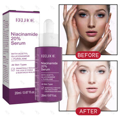 Nicotinamide Face Serum