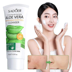 Aloe Vera Facial Cleanser Cleaning Acne Spots Blackhead Skin Control Treatment Oil Shrink Pores Care Moisturizing Refreshin L7T6