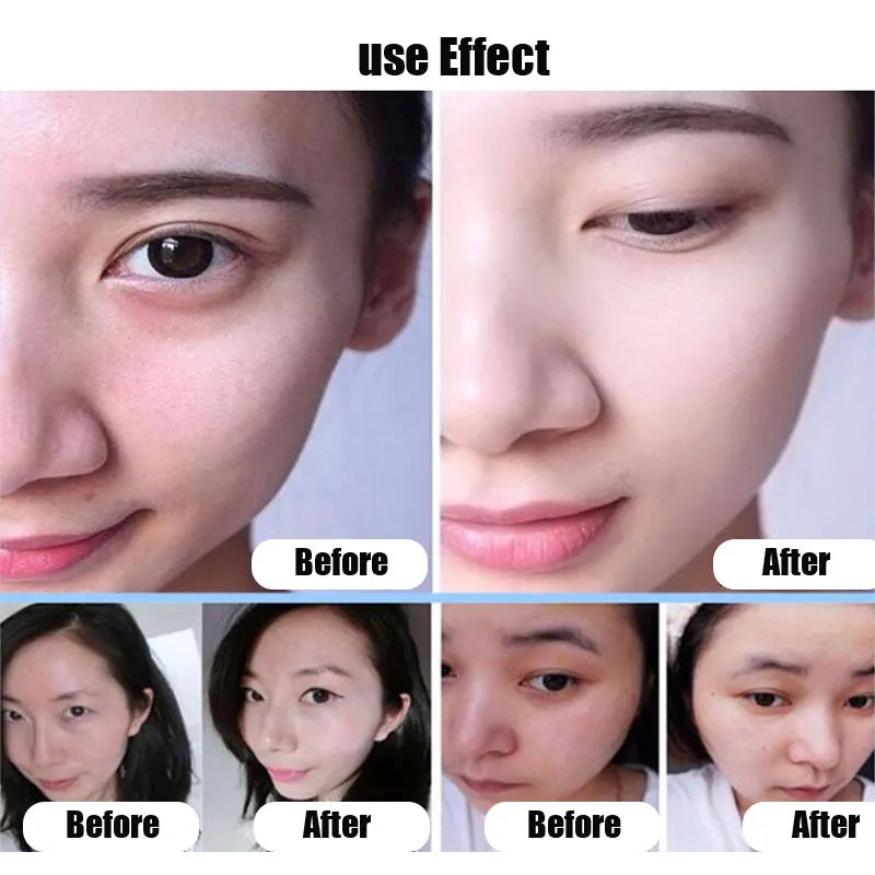 10Pcs Vitamin E Capsule Serum Whitening Face Serum Anti-Wrinkle Anti-Aging Serum for Face Eye Moisturizer Essence Moisturizer