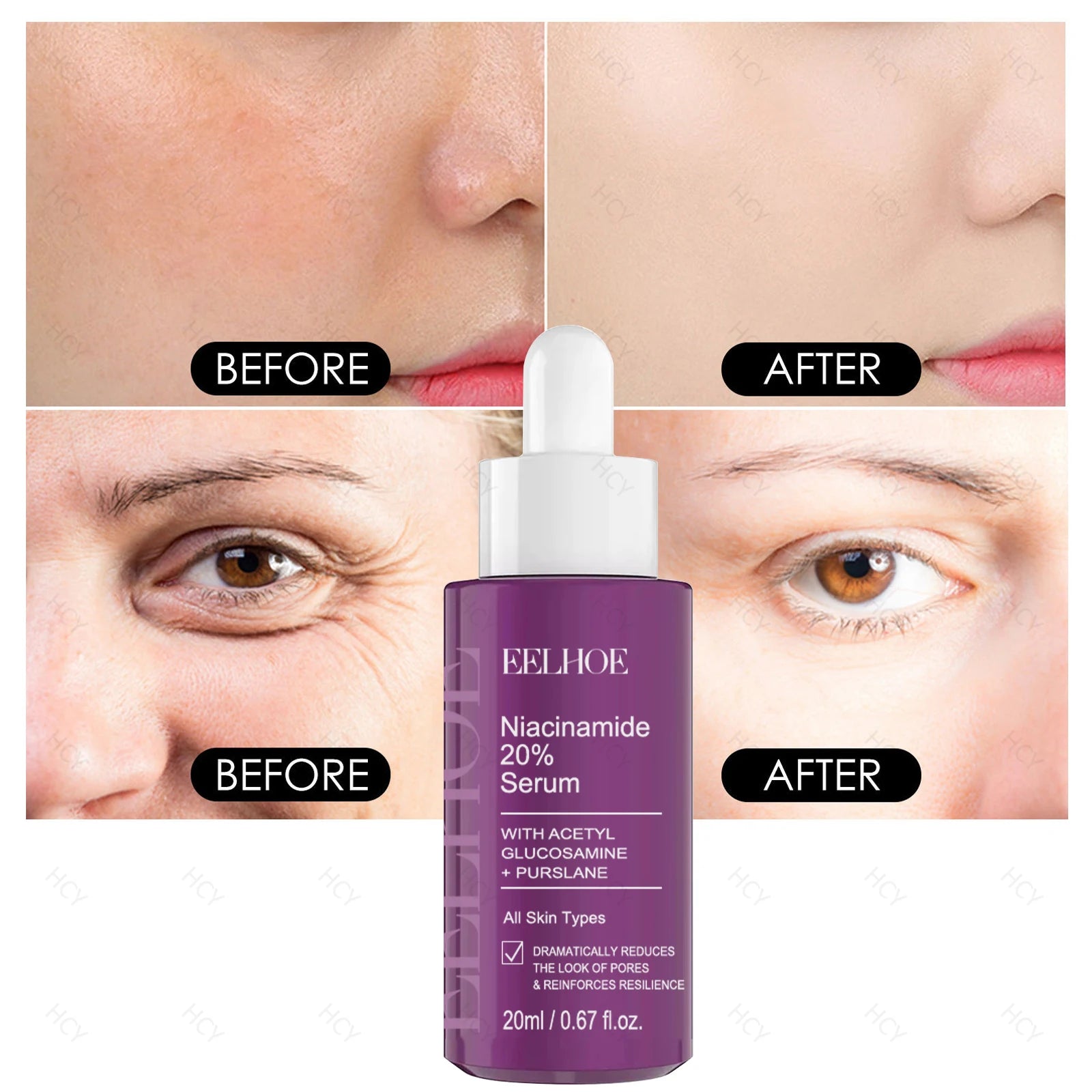 Nicotinamide Face Serum