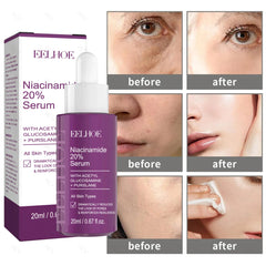 Nicotinamide Face Serum